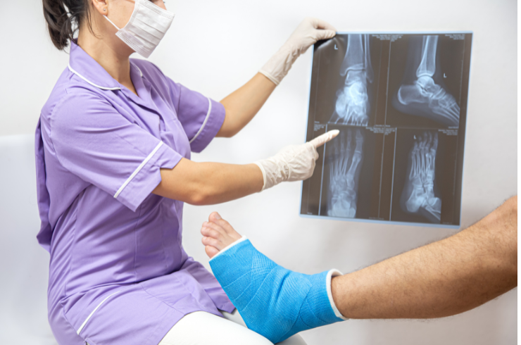 Fracture Treatment