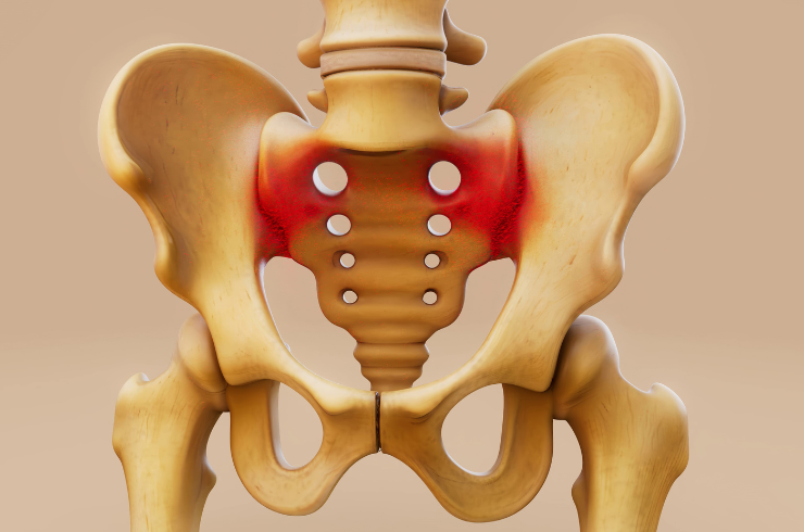 Hip Replacement